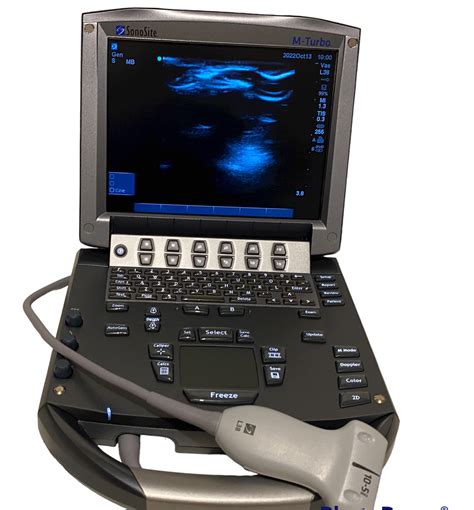 Sonosite M Turbo Portable Ultrasound 2018 With Linear Array Probe L38x