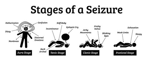 Stages And Phases Of A Seizure Stock Illustration Download Image Now