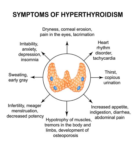 Endocrine Disorders Types Causes Symptoms And Treatments