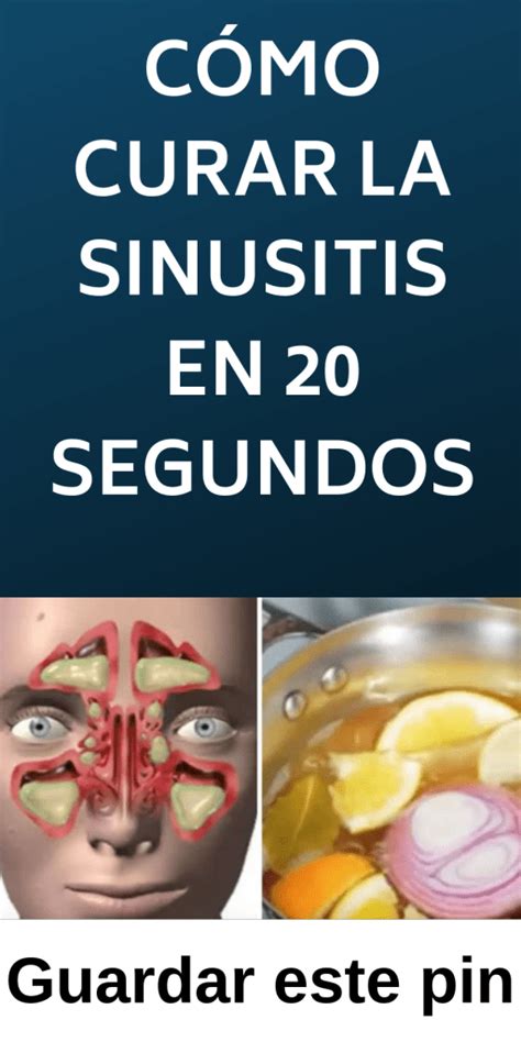 Cómo Curar La Sinusitis En 20 Segundos Salud Mundo Sinusitis