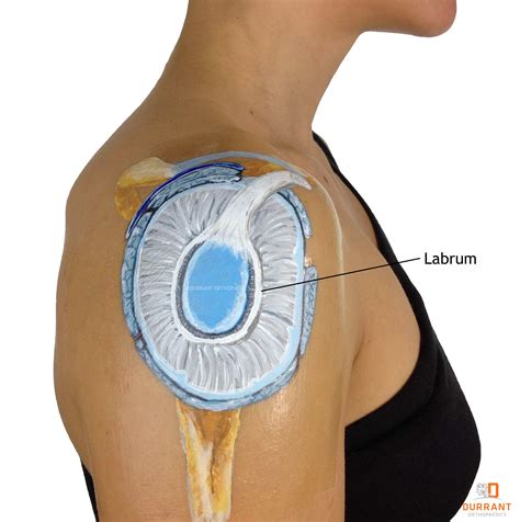 Large round head of the humerus and. Shoulder Dislocation - What You Need To Know As A Patient