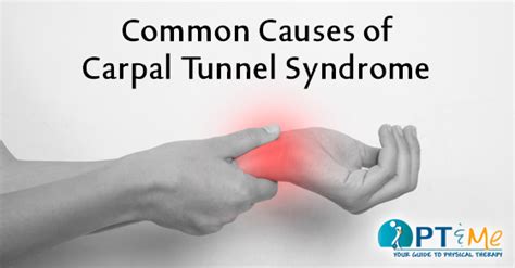 Common Causes Of Carpal Tunnel Syndrome Pt And Me