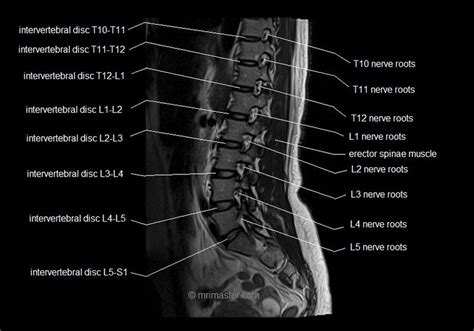 Mri Spine Anatomy Free Mri Lumbar Spine Sagittal Cross Sectional