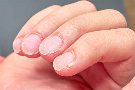 6 Amazing Facts About Fingernails Interesting Facts