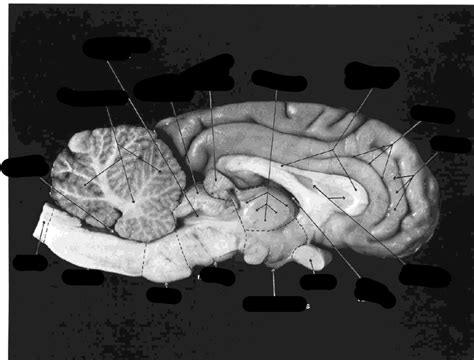 Mid Sagittal Dissection From Dissection Guide Diagram Quizlet