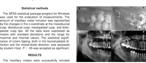 Intrusion Of Maxillary Posterior Teeth With The Mini Implant Anchorage Download Scientific