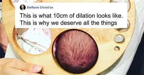 This Dilation Chart Shows The Remarkable Reality Of Childbirth
