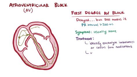 Rd Degree Heart Block Cardiovascular System Heart Blocks Cardiology