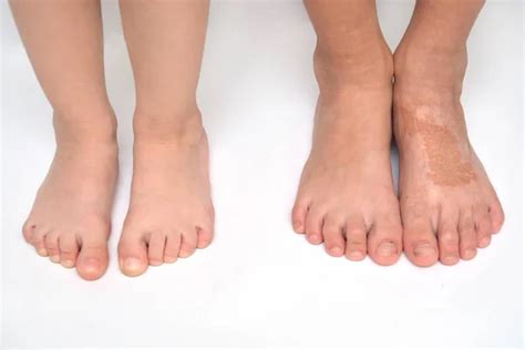 Childs Feet — Stock Photo © Petrop 61400371