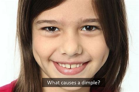 What Causes A Dimple And Why Do Only Some People Have Dimples