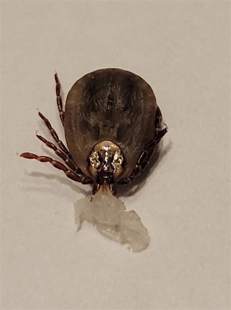 “when I Pulled This Tick Off My Skin Came With It” Tickencounter