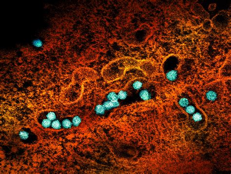 West Nile Virus Transmission Electron Micrograph Of West N Flickr