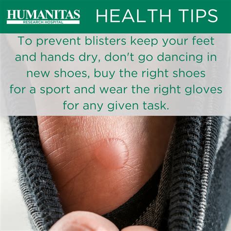 Blisters Are That Painful Fluid Filled Lump That Appears Over Irritated