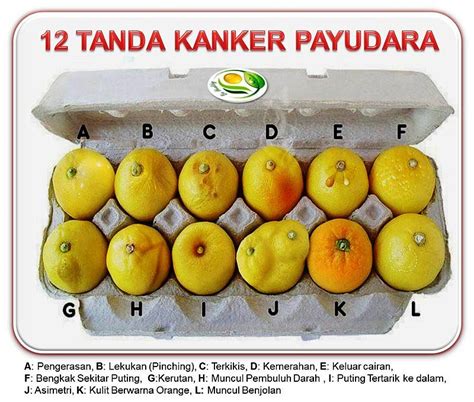 Tetapi bila gumpalan yang tidak normal terus bertumbuh dan menjadi ganas inilah yang disebut kanker. Ghalang Van Laska: Kanker Payudara "Tanda dan Pencegahannya"