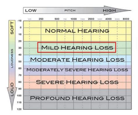 Mild Hearing Loss What Does It Mean Hearing Solutions In The Triangle