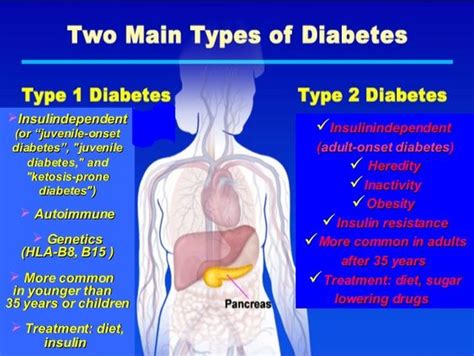 Diabetes Preventive Juvenile Type 2 Diabetes Treatment