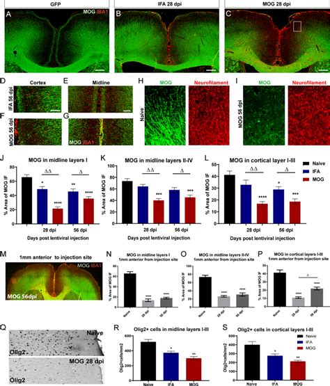 Chronic Expression Of Cytokines Leads To Demyelination Of Subpial