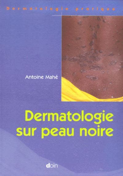 Dermatologie sur peau noire broché Antoine Mahé Achat Livre fnac