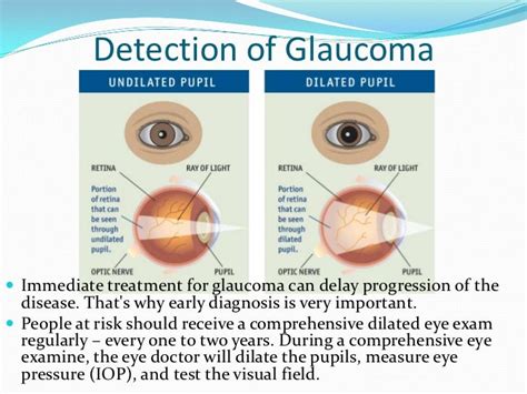 Glaucoma Prevention