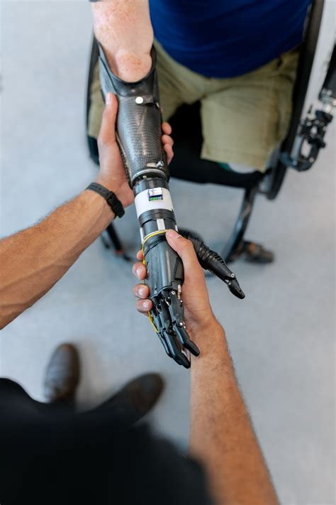 Innovation And Inclusion In Prosthetic Design