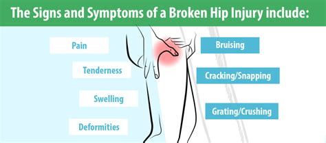 Broken Hip Types Causes And Symptoms Carelinx