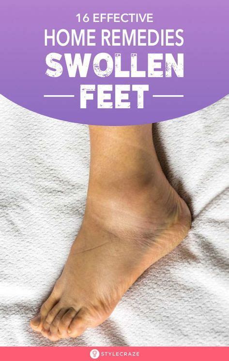 16 Home Remedies For Swollen Feet Symptoms And Treatments Artofit