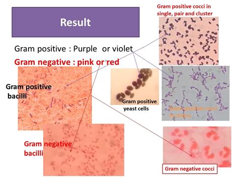 Grams Staining Introduction Principle Procedure Result And