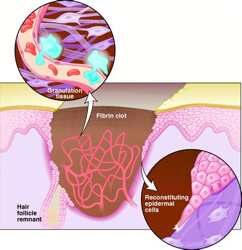 Wound Healing Aiming For Perfect Skin Regeneration Science