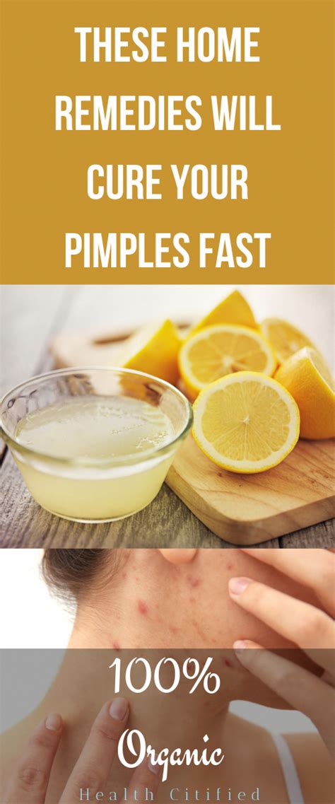 Get Rid Of Pimples Fast At Home 5 Natural Remedies In 2020 How To