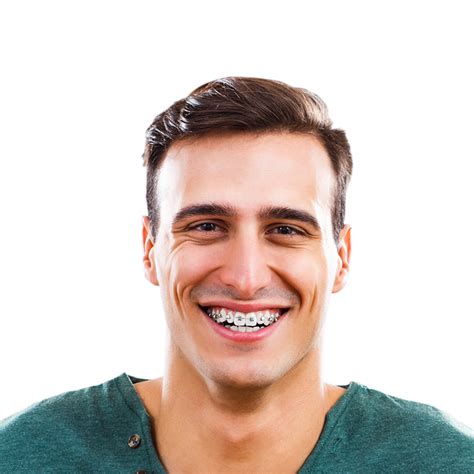Adult Orthodontics Mitchellville Md Silver Spring Md Bowie Md Scott Orthodontics