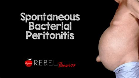 Spontaneous Bacterial Peritonitis Rebel Em Emergency Medicine Blog