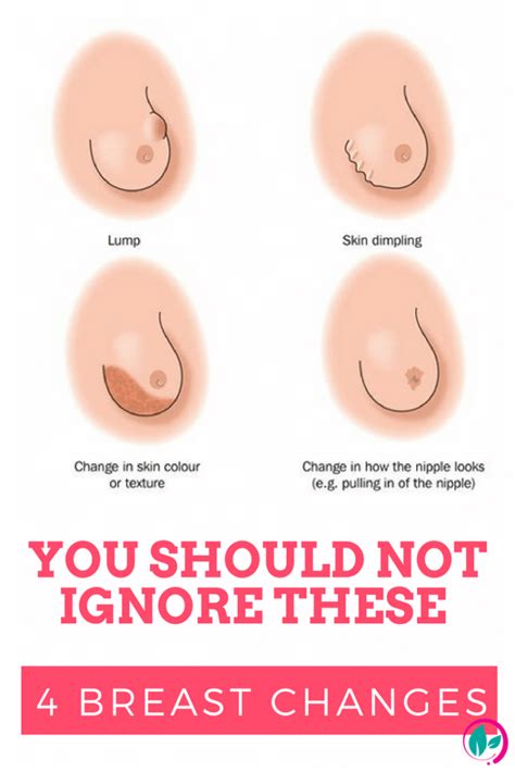 What do lumps in my breast mean? Ladies You Should Never Ignore These 4 Breast Changes!