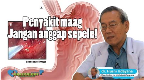 Penyakit gonore atau kencing nanah merupakan salah satu penyakit menular seksual. Apa itu Penyakit Maag ? Ini Penyebab dan Gejalanya - YouTube