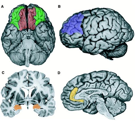 Dysfunction In The Neural Circuitry Of Emotion Regulation A Possible