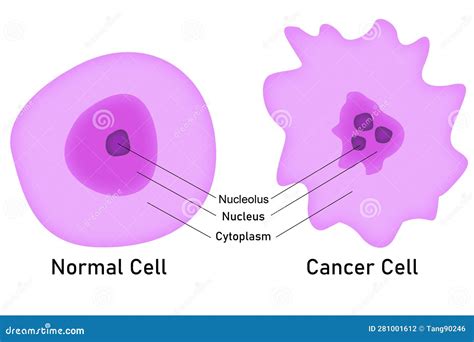Cancer Cell Compare With Normal Cell Stock Illustration Illustration