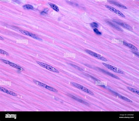 Smooth Muscle Fibers Of The Small Intestine Longitudinally Sectioned