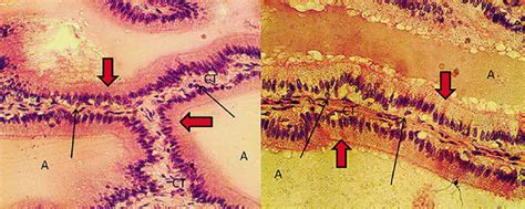 Vesicular Gland Showing Loose Connective Tissue Septa Ct Secretory