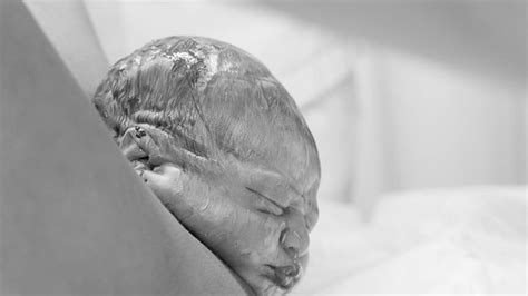 Fascinating Photos Capture Crowning Of Babies Heads Birth Pictures
