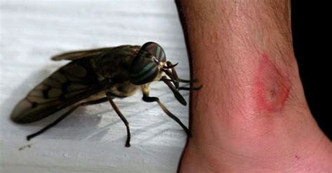 How To Recognize Each One Of These 12 Common Bug Bites Chilling Mode