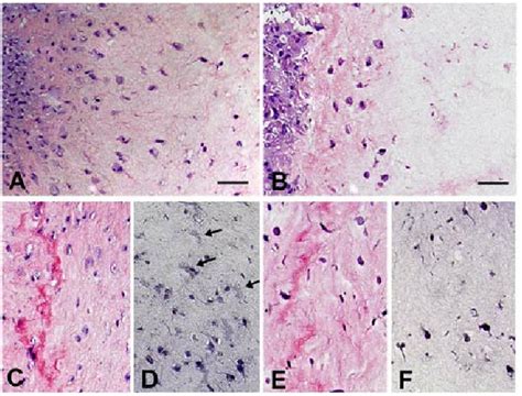 Histological Staining Of Collagen Gel Embedded Fibroblasts Download