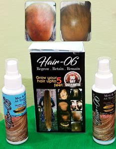 5% minoxidil topical solution for men's hair regrowth, serum reactivates hair follicles. ANTI HAIR LOSS SCALP TREATMENT, REGROWTH GROWTH OIL SERUM ...