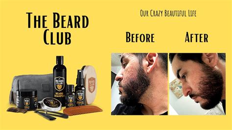 The Beard Club Before And After Results Youtube