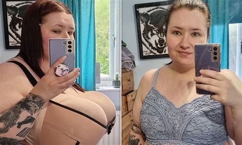 Woman Rejected For Nhs Breast Reduction Surgery Goes Down 21 Cup Sizes Raising £8k For Private