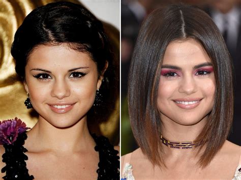 selena gomez plastic surgery before and after