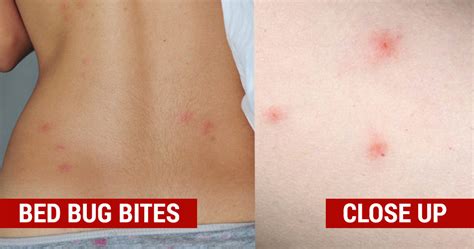 Bed bugs have an outer shell that they shed and leave behind. 12 Natural Ways To Get Rid of Bed Bugs In Your Home