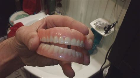 Buy home dental kit partial teeth retainer; DIY dentures teeth and stuff part 2 warning gross - YouTube