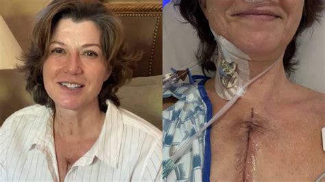 Amy Grant Shares Photos After Undergoing Open Heart Surgery