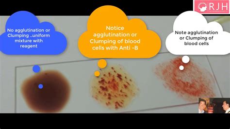 Blood Typing Clumping No Clumping