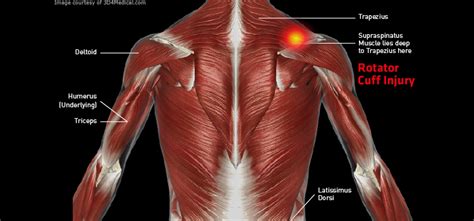 Shoulder and upper arm pain can result from a whole host of different causes. Torso_RotatorCuffInjury_large