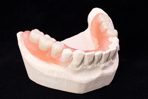 Richfield Dentist Looks At When To Consider Partial Dentures